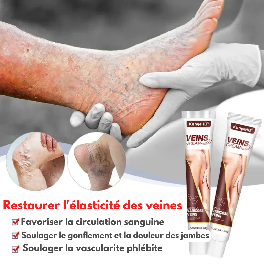Crème Anti Varice Kanye™ : Restaure les veines endommagé✨